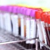 A Lab Test for Bipolar Disorder?