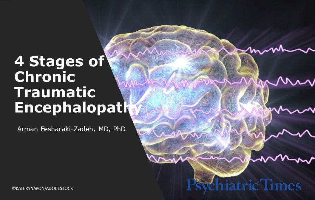 4 Stages of Chronic Traumatic Encephalopathy