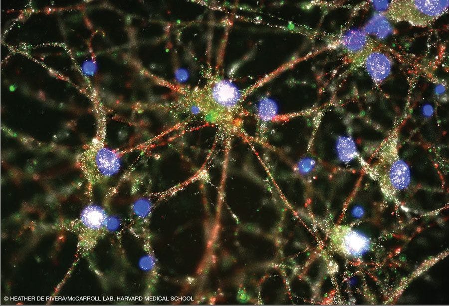Image of human neurons showing complement component 4 in neuronal processes