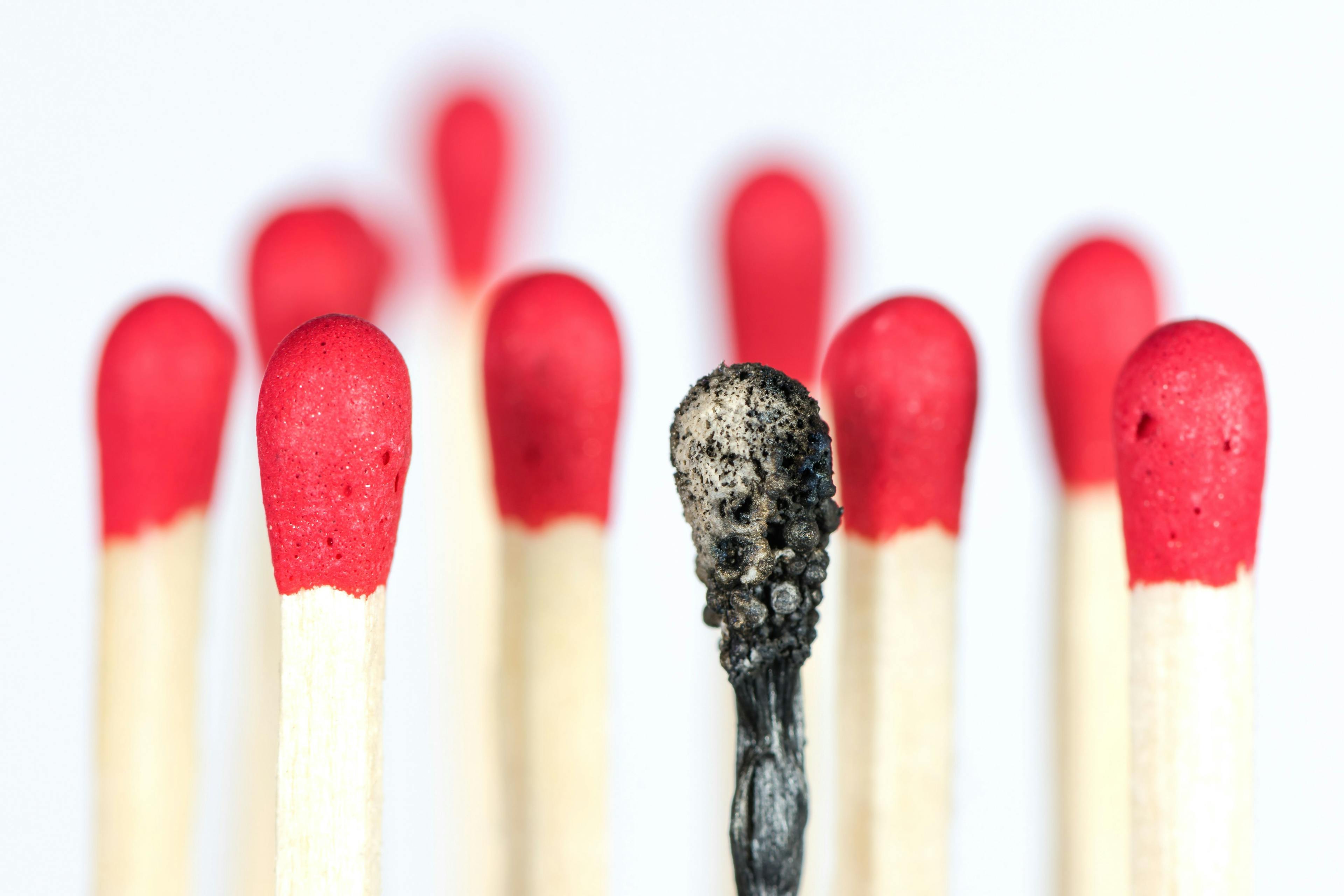 5 Tips to Prevent or Alleviate Burnout