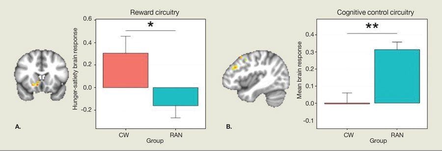 Activity within the dorsolateral cognitive circuitry