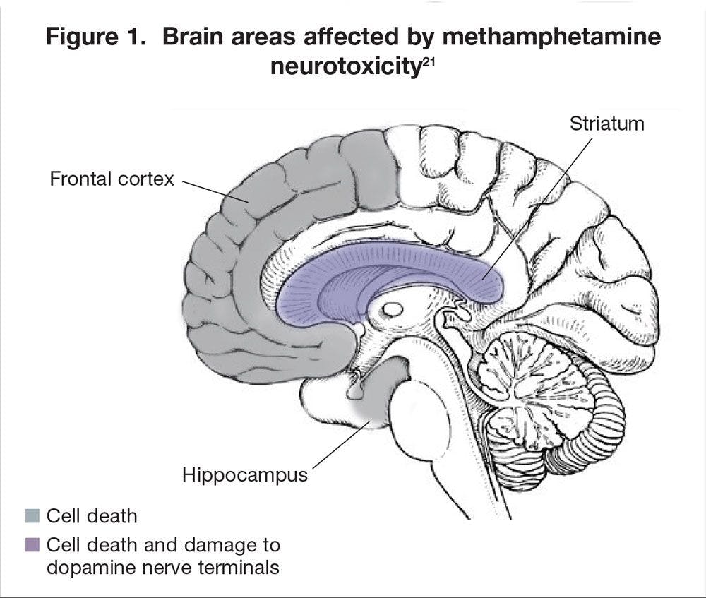 Brain areas affected by methamphetamine neurotoxicity