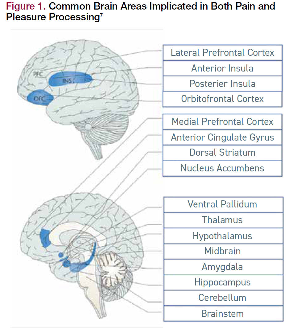 Figure 1. Common Brain Areas Implicated in Both Pain and Pleasure Processing