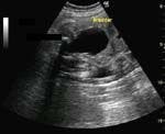 DailyDx: Fetal Kidney