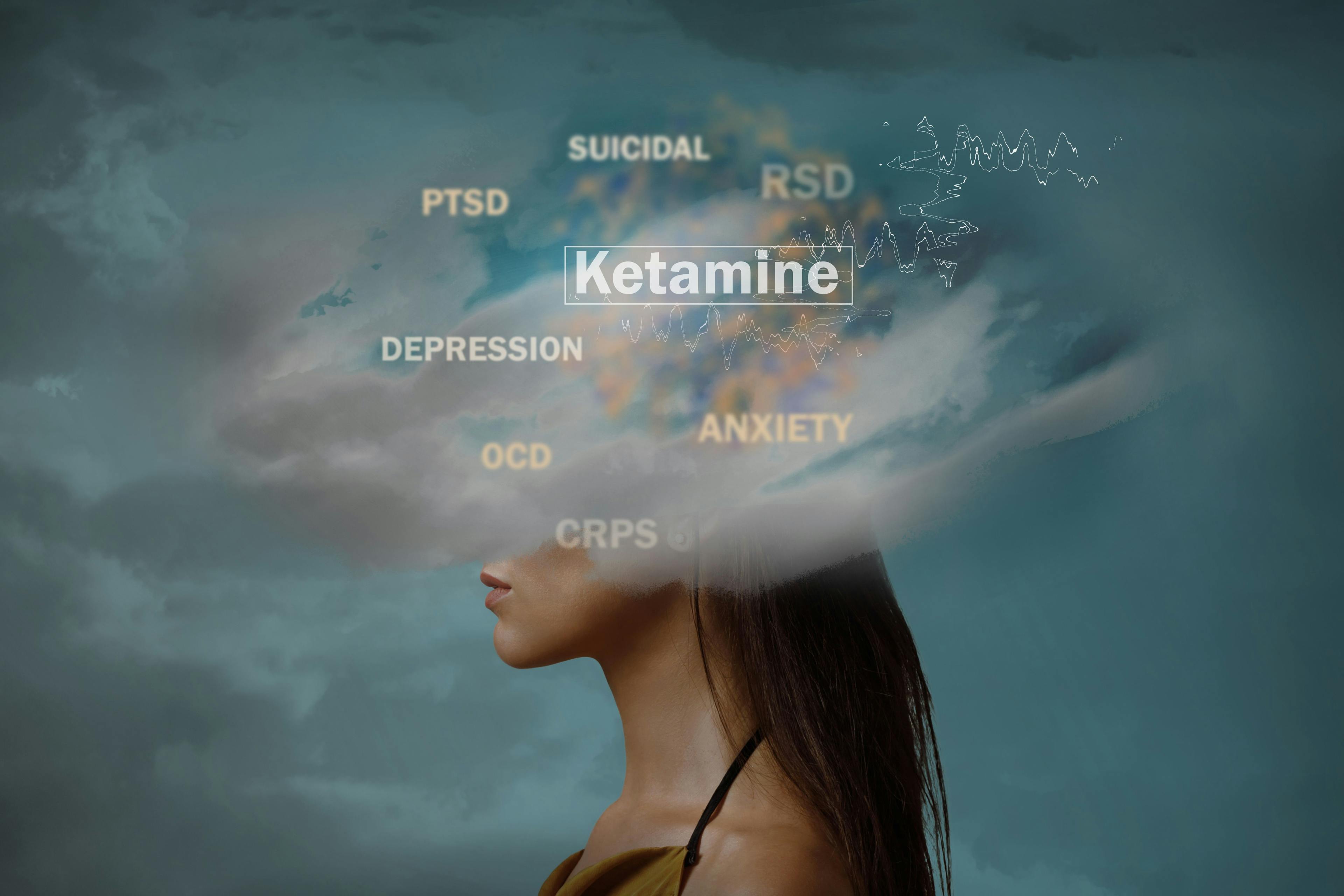 Ketamine for anxiety? Researchers performed a systematic review and meta-analysis of ketamine’s anxiolytic effects.