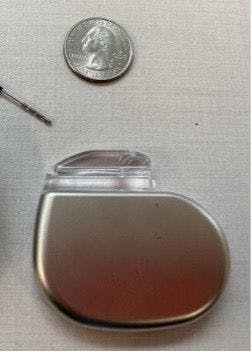  Figure 1. Comparing DBS Electrode Size to a Quarter and Pacemaker 