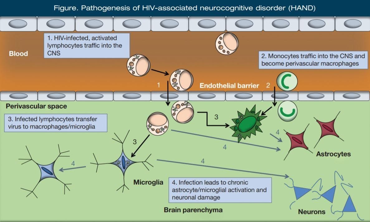 Pathogenesis of HIV-associated neurocognitive disorder (HAND)