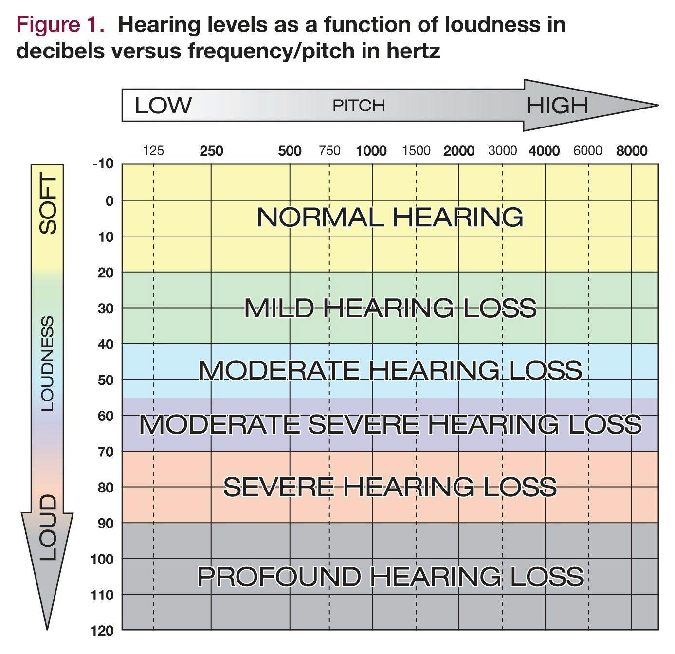Hearing levels in decibels versus frequency/pitch in hertz
