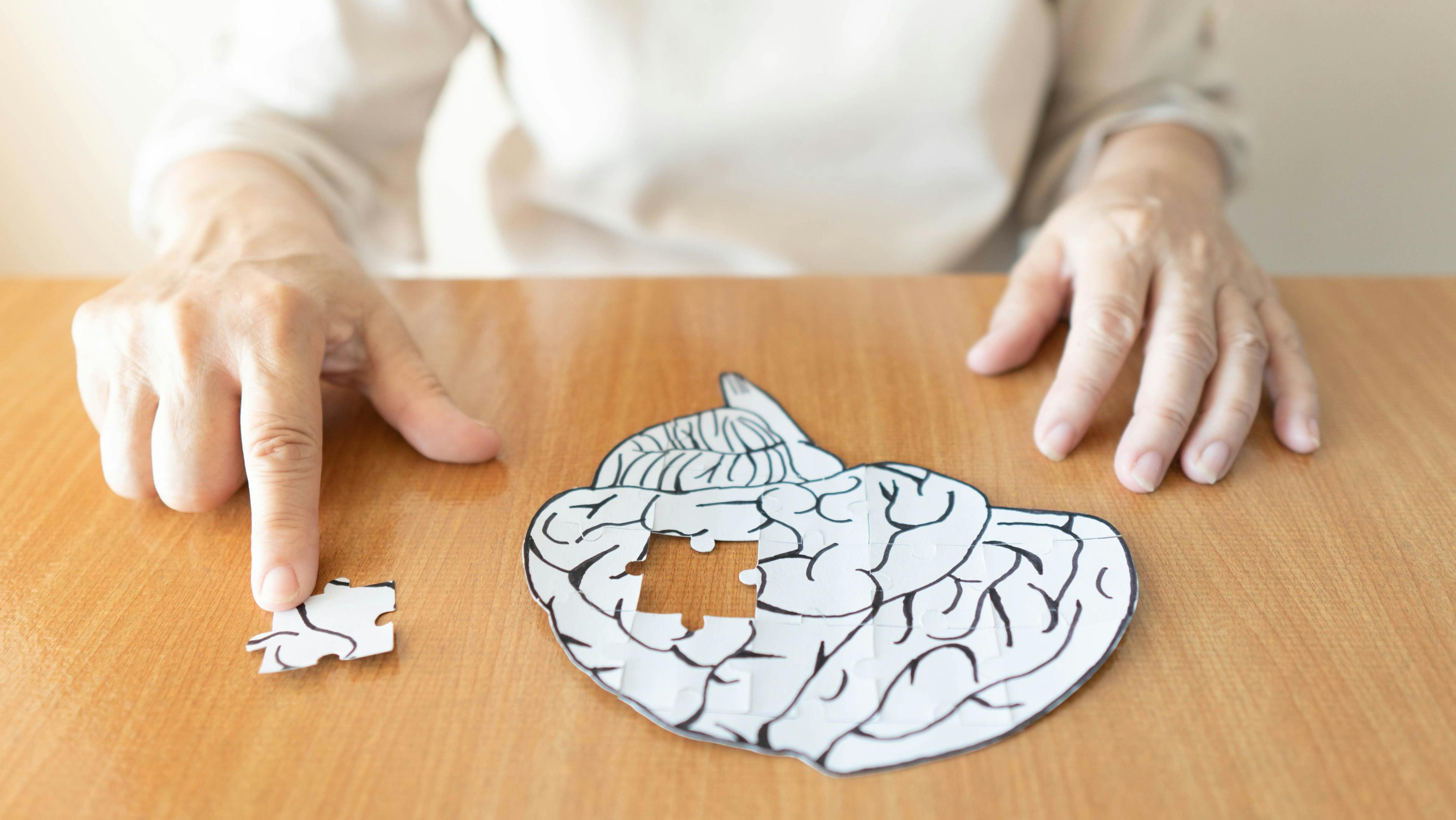 First New Treatment Approved for Alzheimer Disease in Nearly 2 Decades