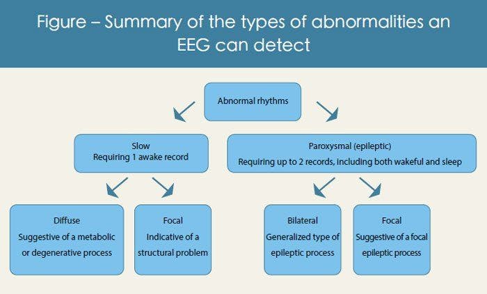 Figure: Summary of the types of abnormalities an EEG can detect