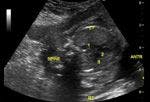 DailyDx: Can You Identify These Fetal Cardiac Structures?